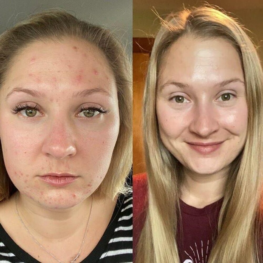 Best Vitamin C Serum - Monat C Radiance